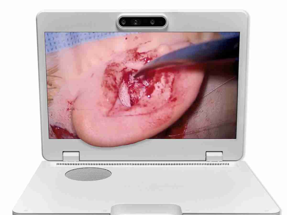 达擎之＂Heads-up 3D显微手术显示系统＂，，，整合4K裸眼3D显示及眼球追踪系统，，具备快速追踪人眼移动位置功能，，减轻医师长时间维持固定姿势的负担，，，让医师能有更宽广清晰的3D立体视野及更舒适的姿势来执行手术。。。。